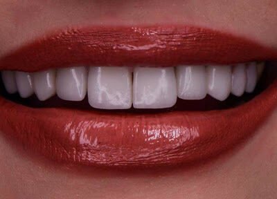 Lakeshore Dentistry