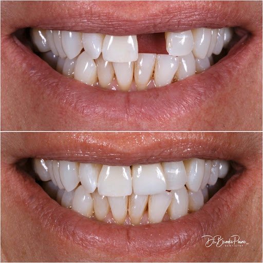 Carolina Complete Dentistry