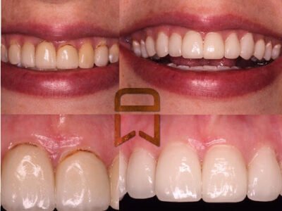 Lineberger Dentistry