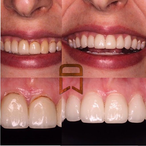 Lineberger Dentistry