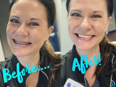 University Orthodontics
