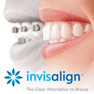 Clearsmile Orthodontics (South End)