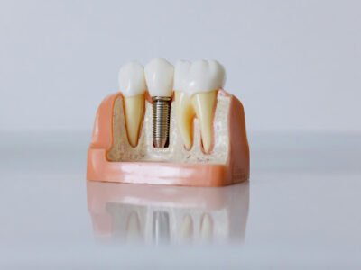 Pinnacle Periodontics & Dental Implants