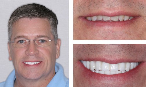 Harrell Dental Implant Center